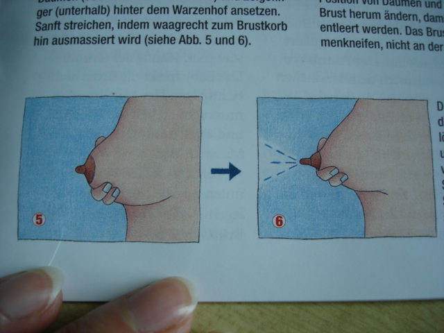 急性乳腺炎排奶手法图片